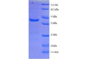 Image no. 1 for Cytochrome C Oxidase Subunit Va (COX5A) (AA 42-150), (full length) protein (GST tag) (ABIN1608000)