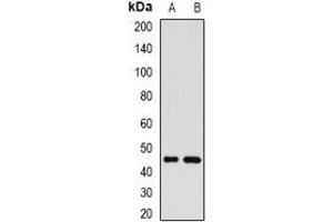 Image no. 3 for anti-Golgi Membrane Protein 1 (GOLM1) antibody (ABIN2966681)