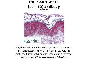 Image no. 1 for anti-rho Guanine Nucleotide Exchange Factor (GEF) 11 (ARHGEF11) (AA 1-50) antibody (ABIN1731940)