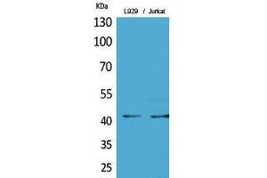 Image no. 1 for anti-E2F Transcription Factor 4, P107/p130-Binding (E2F4) (acLys96) antibody (ABIN3181883)