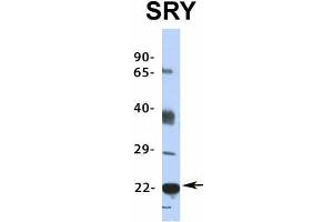 Image no. 2 for anti-Sex Determining Region Y (SRY) (Middle Region) antibody (ABIN2776027)