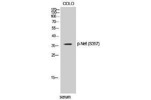 Image no. 1 for anti-Solute Carrier Family 6 (Neurotransmitter Transporter, Noradrenalin), Member 2 (SLC6A2) (pSer357) antibody (ABIN3182797)