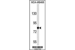 Image no. 1 for anti-Ecotropic Viral Integration Site 5 (EVI5) (AA 191-220), (N-Term) antibody (ABIN653115)