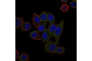Image no. 8 for anti-ATP-Binding Cassette, Sub-Family B (MDR/TAP), Member 5 (ABCB5) (AA 481-674) antibody (ABIN1842667)