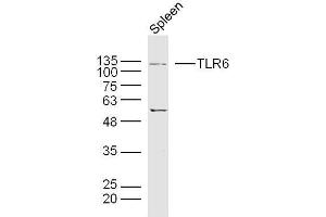 Image no. 7 for anti-Toll-Like Receptor 6 (TLR6) (AA 301-400) antibody (ABIN749573)