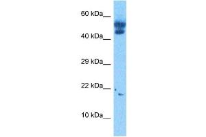 Image no. 5 for anti-Transcription Factor 21 (TCF21) (N-Term) antibody (ABIN2777930)