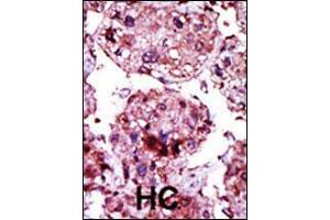 Image no. 3 for anti-Hexokinase 1 (HK1) (AA 78-108), (N-Term) antibody (ABIN392759)