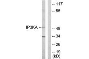 Image no. 1 for anti-Inositol-Trisphosphate 3-Kinase A (ITPKA) (AA 396-445) antibody (ABIN1533667)