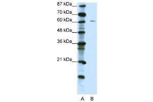 Image no. 2 for anti-Zinc Finger Protein 268A (ZNF286A) (C-Term) antibody (ABIN2781107)