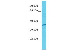 anti-Calmodulin-Lysine N-Methyltransferase (CAMKMT) (C-Term) antibody