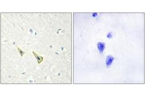 Immunohistochemistry analysis of paraffin-embedded human brain, using Calsenilin/KCNIP3 (Phospho-Ser63) Antibody.