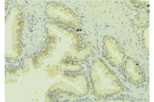 Image no. 1 for anti-Chemokine (C-C Motif) Ligand 13 (CCL13) antibody (ABIN6260535)