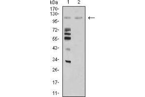 Image no. 4 for anti-Mindbomb E3 Ubiquitin Protein Ligase 1 (MIB1) (AA 6-221) antibody (ABIN5542433)