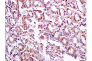 Image no. 1 for anti-Deleted in Malignant Brain Tumors 1 (DMBT1) (AA 1701-1785) antibody (ABIN670626)