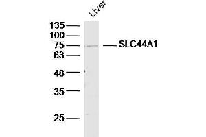 Image no. 2 for anti-Solute Carrier Family 44, Member 1 (SLC44A1) (AA 81-180) antibody (ABIN702370)