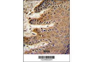 Image no. 2 for anti-Cell Division Cycle 37 Homolog (S. Cerevisiae) (CDC37) (AA 116-144) antibody (ABIN652914)