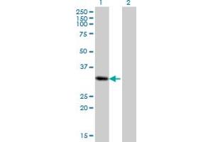 Image no. 1 for anti-Paired Related Homeobox 2 (PRRX2) (AA 151-253) antibody (ABIN526736)
