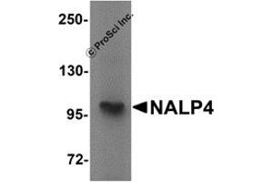 Western Blotting (WB) image for anti-NLR Family, Pyrin Domain Containing 4 (NLRP4) (Middle Region) antibody (ABIN1031008)
