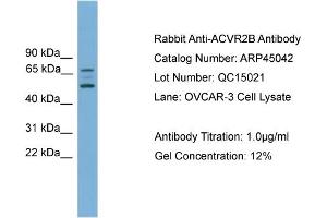 Image no. 2 for anti-Activin A Receptor, Type IIB (ACVR2B) (Middle Region) antibody (ABIN2782111)