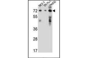 Image no. 2 for anti-Hydroxysteroid (17-Beta) Dehydrogenase 4 (HSD17B4) (AA 340-370), (Middle Region) antibody (ABIN950184)