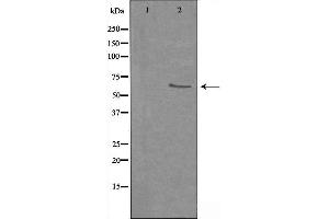 Image no. 2 for anti-Synaptotagmin Binding, Cytoplasmic RNA Interacting Protein (SYNCRIP) antibody (ABIN6257868)