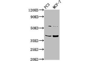 PCGF6 Antikörper  (AA 9-70)