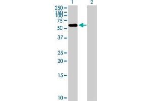 Image no. 1 for anti-F-Box Protein 3 (FBXO3) (AA 1-471) antibody (ABIN525680)