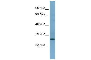 Image no. 1 for anti-APAF1 Interacting Protein (APIP) (Middle Region) antibody (ABIN633024)