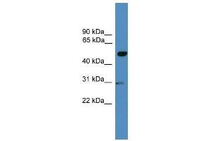 anti-Galactose-3-O-Sulfotransferase 3 (GAL3ST3) (Middle Region) antibody