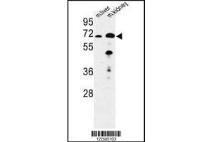 Western Blotting (WB) image for anti-Enoyl-CoA, Hydratase/3-Hydroxyacyl CoA Dehydrogenase (EHHADH) antibody (ABIN2158658)