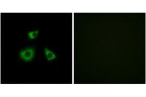 Image no. 2 for anti-Mitochondrial Ribosomal Protein L52 (MRPL52) (AA 71-120) antibody (ABIN1534535)