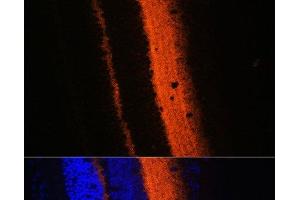 Immunofluorescence analysis of Mouse eye using SYT1 Polyclonal Antibody at dilution of 1:100 (40x lens).