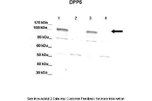 Image no. 2 for anti-Dipeptidyl-Peptidase 6 (DPP6) (Middle Region) antibody (ABIN2782044)
