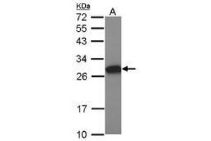 Image no. 1 for anti-Metallothionein-Like 5, Testis-Specific (Tesmin) (MTL5) (AA 1-311) antibody (ABIN1499585)