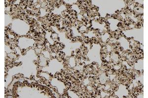 Image no. 2 for anti-Pancreatic and Duodenal Homeobox 1 (PDX1) (Internal Region) antibody (ABIN6266306)