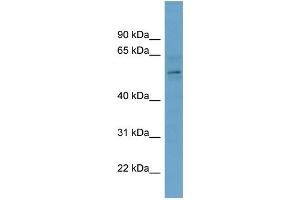 Image no. 1 for anti-Chromobox Homolog 2 (CBX2) (Middle Region) antibody (ABIN2787656)