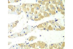 Immunohistochemistry of paraffin-embedded Mouse heart using TBXAS1 Polyclonal Antibody at dilution of 1:100 (40x lens).