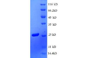 SDS-PAGE (SDS) image for RS4, Ribosomal Protein 4 (RS4) (AA 2-206) protein (His tag) (ABIN5712592)