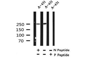 Image no. 1 for anti-Desmoplakin (DSP) (pSer165), (pSer166) antibody (ABIN6268026)
