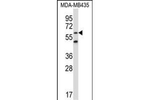 ZNF479 抗体  (N-Term)
