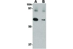 Image no. 2 for anti-Solute Carrier Family 22 (Organic Cation Transporter), Member 17 (SLC22A17) (C-Term) antibody (ABIN6656723)