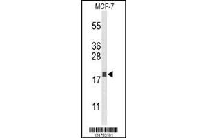 Image no. 1 for anti-Anterior Gradient 3 (AGR3) (AA 119-147), (C-Term) antibody (ABIN653373)