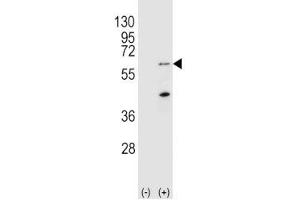 Image no. 1 for anti-PTEN Induced Putative Kinase 1 (PINK1) (AA 118-147) antibody (ABIN3032405)