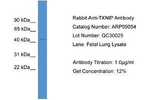 Image no. 2 for anti-Thioredoxin Interacting Protein (TXNIP) (Middle Region) antibody (ABIN2787922)