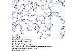 Image no. 1 for anti-Myb-Binding Protein 1A (MYBBP1A) (C-Term) antibody (ABIN2780004)