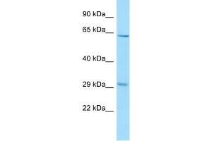 Image no. 1 for anti-Receptor Accessory Protein 3 (REEP3) (C-Term) antibody (ABIN2790577)