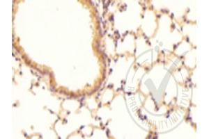 Image no. 1 for anti-Coagulation Factor III (thromboplastin, Tissue Factor) (F3) (AA 32-100) antibody (ABIN708086)