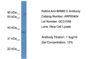 Image no. 1 for anti-Breast Cancer Metastasis-Suppressor 1-Like (BRMS1L) (C-Term) antibody (ABIN2788437)