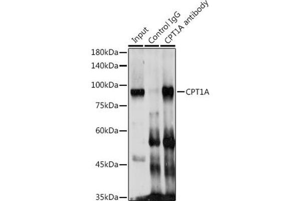 CPT1A antibody  (AA 497-756)