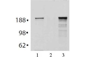 Image no. 2 for anti-Tet Methylcytosine Dioxygenase 2 (TET2) (AA 1-300) antibody (ABIN6972863)